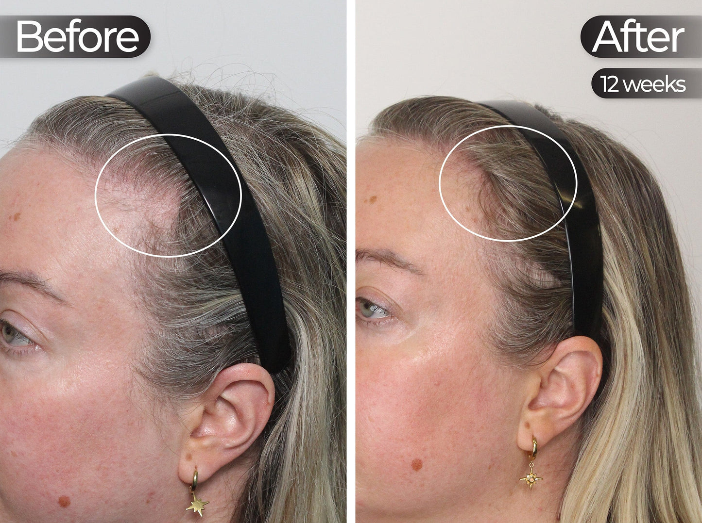 Professional Face Care Bundle